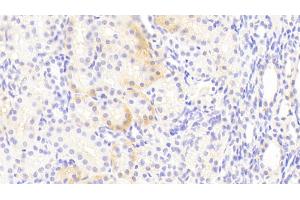 Detection of EAAT3 in Human Kidney Tissue using Polyclonal Antibody to Excitatory Amino Acid Transporter 3 (EAAT3) (SLC1A1 antibody  (AA 115-209))