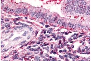 Anti-TBXA2R antibody  ABIN1049407 IHC staining of human uterus. (TBXA2R antibody  (Cytoplasmic Domain))