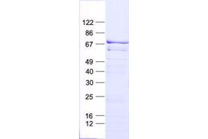 Western Blotting (WB) image for Mitogen-Activated Protein Kinase Kinase Kinase 3 (MAP3K3) protein (His tag) (ABIN2725400)