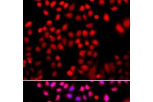 Immunofluorescence analysis of A549 cells using CFL2 Polyclonal Antibody (Cofilin 2 antibody)