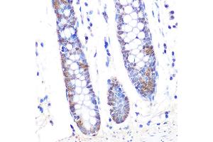 Immunohistochemistry of paraffin-embedded human colon using Thioredoxin 1 (Trx1/TXN) Rabbit mAb (ABIN1679926, ABIN3018425, ABIN3018426 and ABIN7101611) at dilution of 1:100 (40x lens). (TXN antibody)