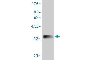 Western Blot detection against Immunogen (39. (SAA1 antibody  (AA 1-122))