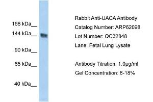 Western Blotting (WB) image for anti-UACA (UACA) (C-Term) antibody (ABIN2774333) (UACA antibody  (C-Term))