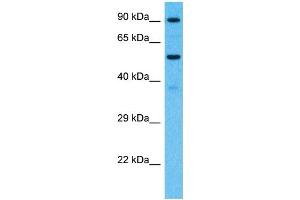 Host:  Rabbit  Target Name:  PCDHB7  Sample Type:  Fetal Kidney lysates  Antibody Dilution:  1. (PCDHb7 antibody  (Middle Region))