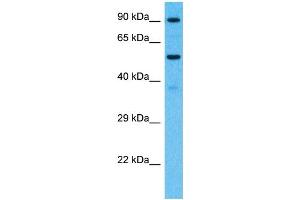 Host:  Rabbit  Target Name:  PCDHB7  Sample Type:  Fetal Kidney lysates  Antibody Dilution:  1.