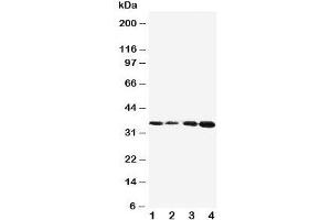 Western blot testing of Protein C antibody and Lane 1:  Jurkat;  2: CEM;  3: SMMC-7721;  4: HeLa cell lysate.