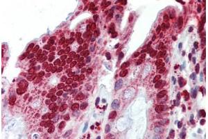 Human Colon (formalin-fixed, paraffin-embedded) stained with BXDC5 antibody ABIN462228 followed by biotinylated goat anti-rabbit IgG secondary antibody ABIN481713, alkaline phosphatase-streptavidin and chromogen. (RPF1 antibody  (AA 45-94))