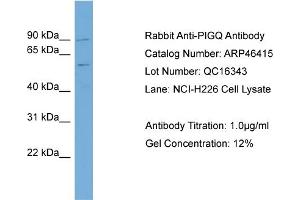 WB Suggested Anti-PIGQ Antibody Titration:  0. (PIGQ antibody  (N-Term))