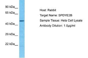 Host: Rabbit Target Name: SPDYE2B Sample Type: Hela Whole Cell lysates Antibody Dilution: 1. (SPDYE2B antibody  (N-Term))