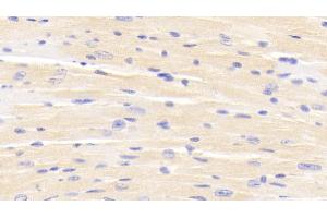 Detection of ERRb in Mouse Cardiac Muscle Tissue using Polyclonal Antibody to Estrogen Related Receptor Beta (ERRb) (ESRRB antibody  (AA 166-438))