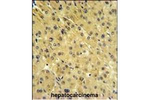 Immunohistochemistry (Paraffin-embedded Sections) (IHC (p)) image for anti-Folate Hydrolase 1B (FOLH1B) (AA 155-183) antibody (ABIN651259)