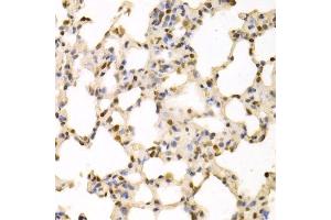 Immunohistochemistry of paraffin-embedded rat lung using SFN Antibody. (14-3-3 sigma/SFN antibody  (AA 1-248))