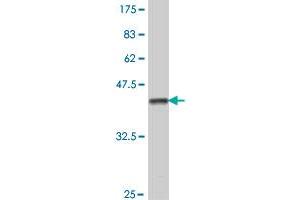 Western Blot detection against Immunogen (37 KDa) . (PDK4 antibody  (AA 181-280))