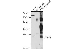 Immunoprecipitation analysis of 200 μg extracts of MCF-7 cells, using 3 μg R antibody (ABIN6132225, ABIN6146561, ABIN6146562 and ABIN6224440). (RAB24 antibody  (AA 1-203))