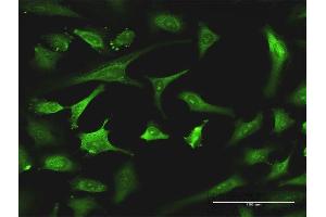 Immunofluorescence of monoclonal antibody to EXOSC8 on HeLa cell. (EXOSC8 antibody  (AA 177-276))