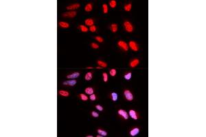 Immunofluorescence analysis of U2OS cells using PRPF3 antibody (ABIN5973192). (PRPF3 antibody)