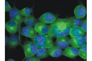 Immunofluorescence staining (mouse neuroblastoma cells) Immunofluorescence staining of Neuro2a mouse neuroblastoma cell line using anti-betaIII-tubulin (TU-20 ; green; 3 μg/ml). (TUBB3 antibody  (N-Term) (FITC))
