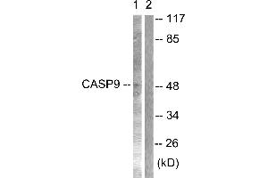 Immunohistochemical analysis of paraffin-embedded human lung carcinoma tissue using Caspase 9 (Ab-125) antibodyWestern blot analysis of extracts from NIH/3T3 cells treated with TNF-α (20ng/ml, 30min), using Caspase 9 (Ab-125) antibody