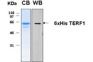 10% SDS-PAGE stained with Coomassie Blue (CB), immunobloting with anti-6xHis (WB) serum and peptide fingerprinting by MALDI-TOF-TOF mass spectrometry (TRF1 Protein (AA 1-419) (His tag))