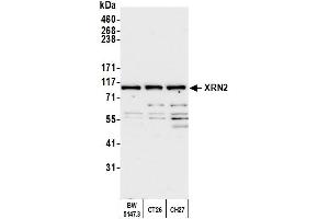 Western Blotting (WB) image for anti-5'-3' Exoribonuclease 2 (XRN2) (AA 900-950) antibody (ABIN7454718)