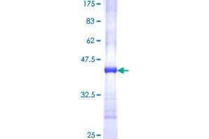 FADS1 Protein (AA 1-99) (GST tag)