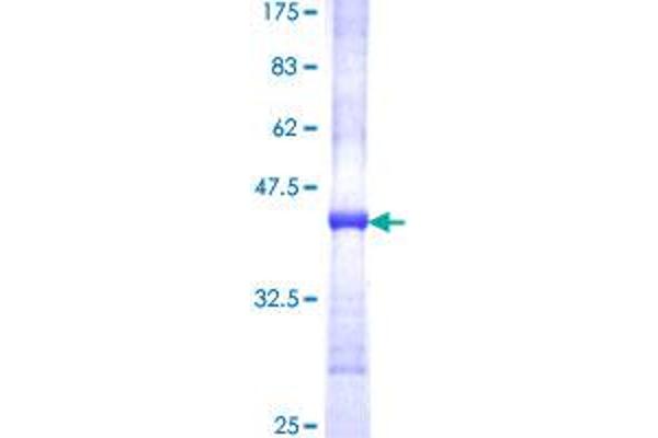 FADS1 Protein (AA 1-99) (GST tag)