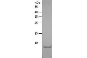Western Blotting (WB) image for S100 Calcium Binding Protein A10 (S100A10) (AA 1-97) protein (His tag) (ABIN7286614) (S100A10 Protein (AA 1-97) (His tag))