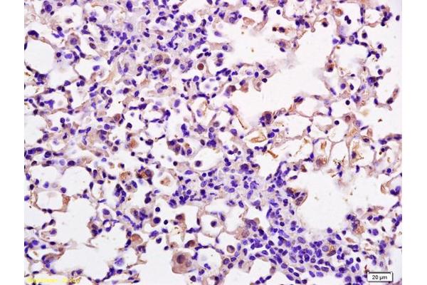 DOK2 antibody  (pTyr351)
