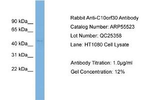 WB Suggested Anti-C10orf30  Antibody Titration: 0. (BEND7 antibody  (N-Term))