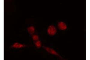 ABIN6274184 staining HeLa cells by IF/ICC. (ATF7 antibody  (N-Term))