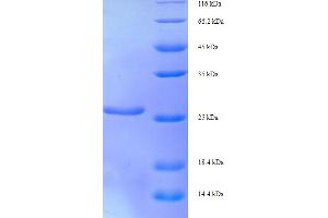 SDS-PAGE (SDS) image for X-Ray Repair Complementing Defective Repair in Chinese Hamster Cells 5 (Double-Strand-Break Rejoining) (XRCC5) (AA 251-455), (partial) protein (His tag) (ABIN5710636) (XRCC5 Protein (AA 251-455, partial) (His tag))