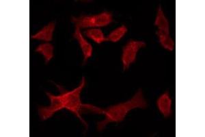 ABIN6277126 staining HuvEc by IF/ICC. (MALT1 antibody  (Internal Region))