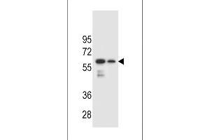 CHST3 Antibody (N-term) (ABIN654418 and ABIN2844154) western blot analysis in mouse spleen and lung tissue lysates (35 μg/lane).