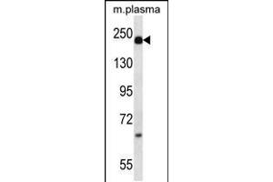 Western blot analysis in mouse plasma lysates (35ug/lane). (alpha 2 Macroglobulin antibody  (N-Term))