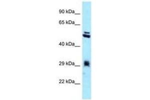 Image no. 1 for anti-Thioredoxin-Related Transmembrane Protein 1 (TMX1) (C-Term) antibody (ABIN6747965) (TMX1 antibody  (C-Term))