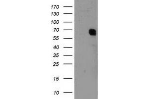 HEK293T cells were transfected with the pCMV6-ENTRY control (Left lane) or pCMV6-ENTRY GTF2F1 (Right lane) cDNA for 48 hrs and lysed. (GTF2F1 antibody)