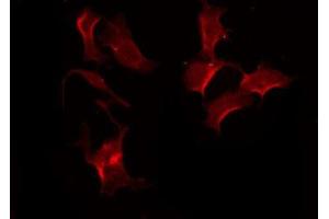 ABIN6275597 staining HeLa by IF/ICC. (SLCO1A2 antibody  (Internal Region))