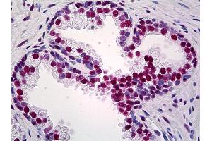 Anti-TRIM28 antibody IHC of human prostate. (KAP1 antibody  (AA 379-524))