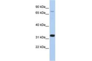 Image no. 1 for anti-Calcium Channel, Voltage-Dependent, beta 2 Subunit (CACNB2) (AA 21-70) antibody (ABIN6742718) (CACNB2 antibody  (AA 21-70))