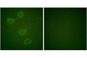 Immunofluorescence analysis of HuvEc cells, using Tyrosine Hydroxylase (Phospho-Ser19) Antibody. (Tyrosine Hydroxylase antibody  (pSer18))