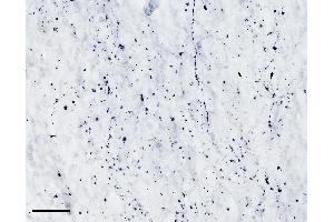 (ABIN768607) (scale bar: 50 μm) immunostaining of TPH2 processes in cryosection of the infundibular nucleus of an immersion-fixed (4 % PFA) human hypothalamus. (Tryptophan Hydroxylase 2 antibody  (AA 16-29))