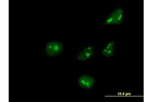 Immunofluorescence of purified MaxPab antibody to ARHGEF10 on HeLa cell.