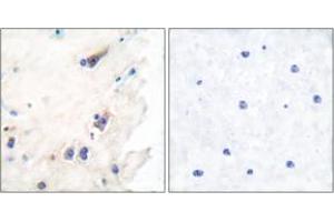 Immunohistochemistry analysis of paraffin-embedded human brain tissue, using PLCB3 (Ab-1105) Antibody. (PLCB3 antibody  (AA 1071-1120))