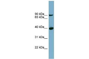WB Suggested Anti-PNPLA8 Antibody Titration: 0. (PNPLA8 antibody  (Middle Region))