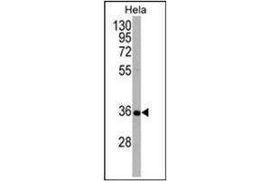 Western blot analysis using ATG5 Antibody (N-term) in Hela cell line lysates (35ug/lane). (ATG5 antibody  (N-Term))