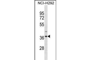 ZN Antibody (N-term) (ABIN1882033 and ABIN2838649) western blot analysis in NCI- cell line lysates (35 μg/lane). (ZNF696 antibody  (N-Term))