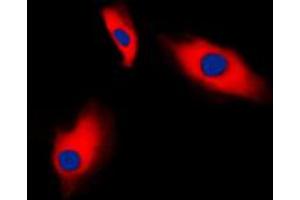 Immunofluorescent analysis of Alpha-actin-3 staining in HeLa cells.