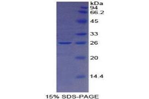 SDS-PAGE (SDS) image for Transferrin Receptor 2 (TFR2) (AA 211-405) protein (His tag) (ABIN1171485)