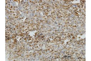 Immunoperoxidase of monoclonal antibody to IL31RA on formalin-fixed paraffin-embedded human spleen. (IL31RA antibody  (AA 21-120))