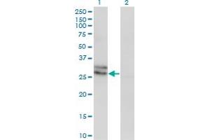 Western Blot analysis of EDN3 expression in transfected 293T cell line by EDN3 monoclonal antibody (M01), clone 2A6-2A4. (Endothelin 3 antibody  (AA 1-238))